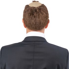 Ein Mann mit rundem Brillengestell trägt eine witzige Halbglatzen-Perücke aus Latex mit braun-grauen Haaren. Perfekt für humorvolle Auftritte, Fasching oder als Politiker-Parodie.