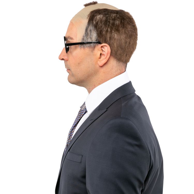 Politiker Perücke Fritze für Herren Ein Mann mit rundem Brillengestell trägt eine witzige Halbglatzen-Perücke aus Latex mit braun-grauen Haaren. Perfekt für humorvolle Auftritte, Fasching oder als Politiker-Parodie.
